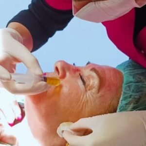 Dermapen facial rejuvenecedor